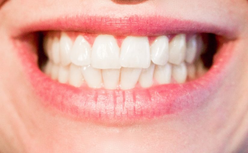 Aktualna technika stosowana w salonach stomatologii estetycznej zdoła sprawić, że odzyskamy ładny uśmiech.